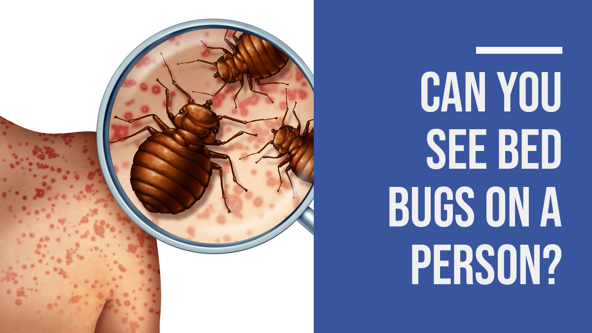 Can You See Bed Bugs On A Person Bay Area Bed Bug